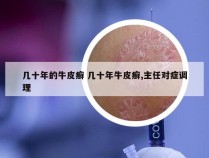 几十年的牛皮癣 几十年牛皮癣,主任对症调理