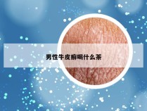 男性牛皮癣喝什么茶