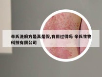 辛氏洗癣方是真是假,有用过得吗 辛氏生物科技有限公司