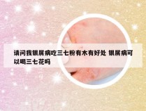 请问我银屑病吃三七粉有木有好处 银屑病可以喝三七花吗