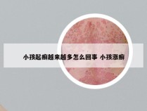 小孩起癣越来越多怎么回事 小孩涨癣