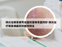 四川治银屑病专业医院是哪家医院好 四川治疗银屑病最好的医院排名