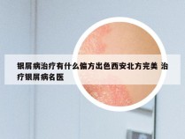 银屑病治疗有什么偏方出色西安北方完美 治疗银屑病名医