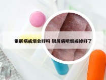 银屑病戒烟会好吗 银屑病吧烟戒掉好了