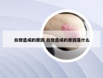 白斑造成的原因 白斑造成的原因是什么