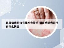 银屑病光照仪有技术含量吗 银屑病照光治疗有什么伤害