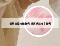 银屑病能吃鲢鱼吗 银屑病能吃鮰鱼吗