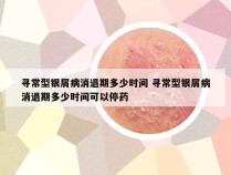 寻常型银屑病消退期多少时间 寻常型银屑病消退期多少时间可以停药