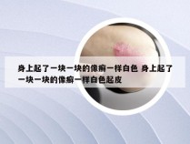 身上起了一块一块的像癣一样白色 身上起了一块一块的像癣一样白色起皮