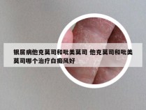 银屑病他克莫司和吡美莫司 他克莫司和吡美莫司哪个治疗白癜风好