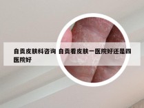 自贡皮肤科咨询 自贡看皮肤一医院好还是四医院好