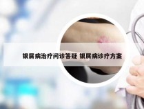 银屑病治疗问诊答疑 银屑病诊疗方案