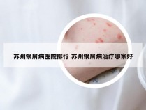 苏州银屑病医院排行 苏州银屑病治疗哪家好