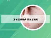 王玉玺银屑病 王玉玺画家