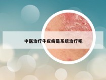 中医治疗牛皮癣是系统治疗吧