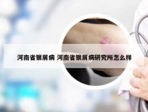 河南省银屑病 河南省银屑病研究所怎么样