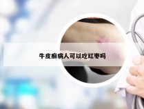 牛皮癣病人可以吃红枣吗
