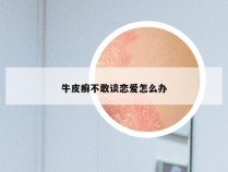 牛皮癣不敢谈恋爱怎么办
