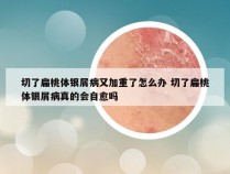 切了扁桃体银屑病又加重了怎么办 切了扁桃体银屑病真的会自愈吗
