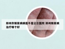 郑州市银屑病病是不是公立医院 郑州银屑病治疗哪个好