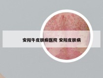 安阳牛皮肤癣医院 安阳皮肤病