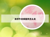 南京牛皮癣医院怎么走