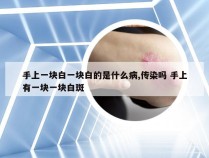 手上一块白一块白的是什么病,传染吗 手上有一块一块白斑