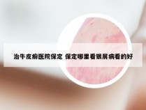 治牛皮癣医院保定 保定哪里看银屑病看的好