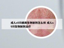 成人still病用生物制剂怎么样 成人still生物制剂治疗