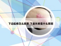 下边起癣怎么回事 下面长癣是什么原因