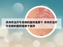滨州市治疗牛皮癣的医院是那个 滨州市治疗牛皮癣的医院是那个医院