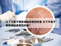 以下不属于银屑病临床类型的是 以下不属于银屑病临床类型的是?