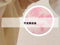 牛皮癣自血
