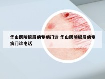 华山医院银屑病专病门诊 华山医院银屑病专病门诊电话