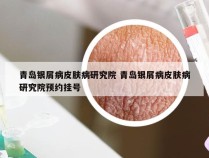 青岛银屑病皮肤病研究院 青岛银屑病皮肤病研究院预约挂号