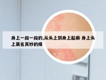 身上一段一段的,从头上到身上起癣 身上头上莫名其妙的痒