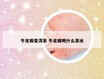 牛皮癣普洱茶 牛皮癣喝什么茶水