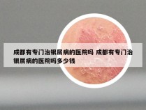 成都有专门治银屑病的医院吗 成都有专门治银屑病的医院吗多少钱