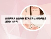 点滴状银屑病扁条体 初发点滴状银屑病把扁道体割了好吗