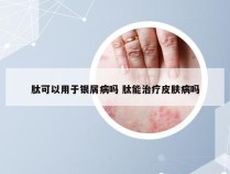 肽可以用于银屑病吗 肽能治疗皮肤病吗