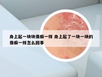 身上起一块块像癣一样 身上起了一块一块的像癣一样怎么回事