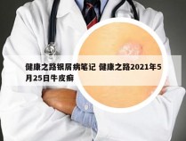 健康之路银屑病笔记 健康之路2021年5月25日牛皮癣