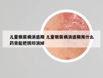 儿童银屑病消退期 儿童银屑病消退期用什么药膏能把斑印消掉