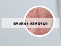银屑病英文名 银屑病医学名称