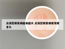 点滴型银屑病越来越大 点滴型银屑病爆发期多久