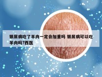 银屑病吃了羊肉一定会加重吗 银屑病可以吃羊肉吗?西医