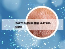 i74770S超频银屑病 i74720hq超频