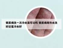 银屑病洗一次冷水澡可以吗 银屑病用热水洗好还是冷水好