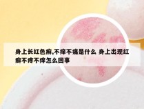 身上长红色癣,不痒不痛是什么 身上出现红癣不疼不痒怎么回事
