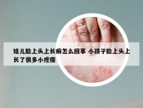 娃儿脸上头上长癣怎么回事 小孩子脸上头上长了很多小疙瘩